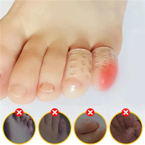 Silicone Anti-Pain Toe Protector